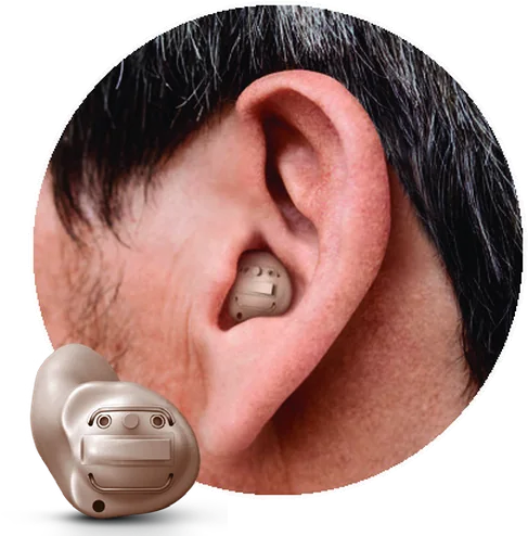 An ear with a skin tone custom shell in the outer part of the canal, and the hearing aid shown alongside
