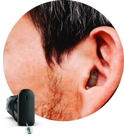 An ear with a small black instant fit hearing aid deep in the canal, and the hearing aid shown alongside