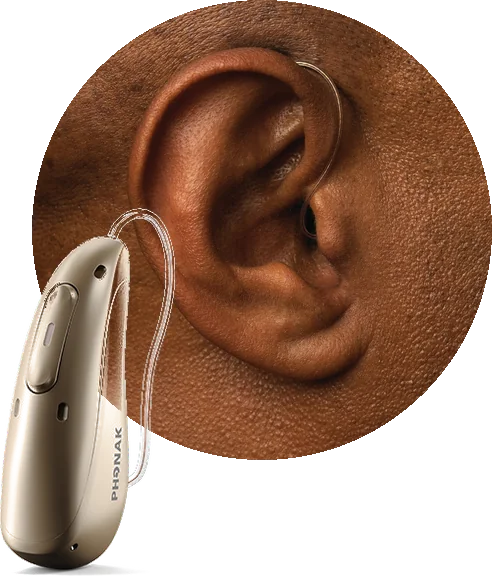 An ear with a Phonak receiver in canal hearing aid in place, its thin wire over the ear, and the hearing aid shown alongside